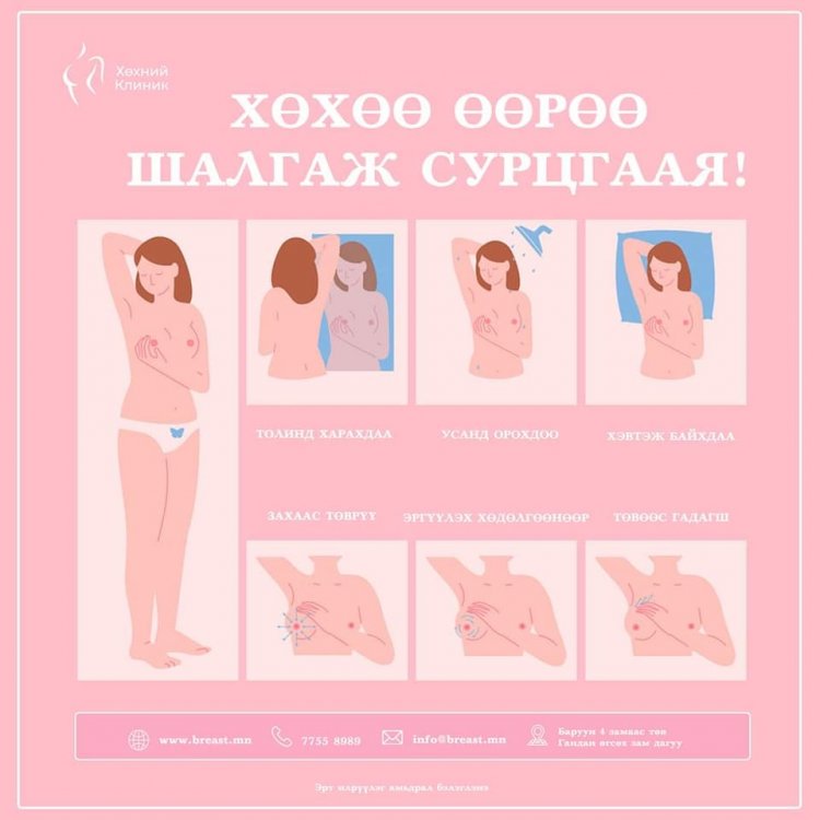 Өөрийн хөхийг өөрөө шалгах 5 алхам